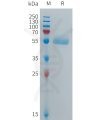 sp-PME101276 CPM Fig.1 SDS PAGE 1
