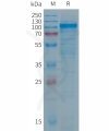 sp-PME101284 PTGFRN Fig.1 SDS PAGE 1