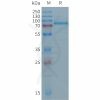 sp-PME101287 DSG2 Fig.1 SDS PAGE 1