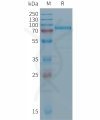 sp-PME101287 DSG2 Fig.1 SDS PAGE 1
