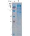 sp-PME101293 CDH19 Fig.1 SDS PAGE 1