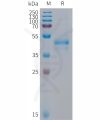 sp-PME101295 ARTN Fig.1 SDS PAGE 1