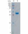 sp-PME101298 p16 Fig.1 SDS PAGE 1