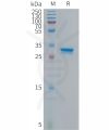sp-PME101300 p16 Fig.1 SDS PAGE 1
