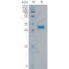 sp-PME101301 p16 Fig.1 SDS PAGE 1