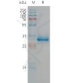 sp-PME101305 CGRP Fig.1 SDS PAGE 1