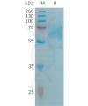 sp-PME101306 CD98 Fig.1 SDS PAGE 1