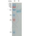 sp-PME101307 IL4 Fig.1 SDS PAGE 1