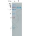 sp-PME101311 LILRB4 Fig.1 SDS PAGE 1