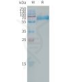 sp-PME101313 CLEC5A Fig.1 SDS PAGE 1
