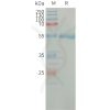 sp-PME101314 CFD Fig.1 SDS PAGE 1