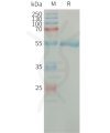 sp-PME101314 CFD Fig.1 SDS PAGE 1