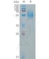 sp-PME101322 CD79A Fig.1 SDS PAGE 1