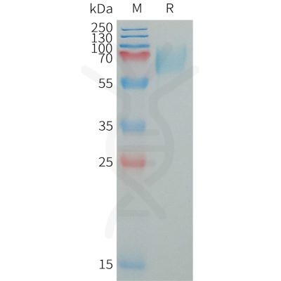 sp-PME101326 LILRA2 Fig.1 SDS PAGE 1