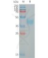 sp-PME101328 MXRA8 Fig.1 SDS PAGE 1