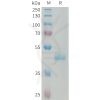 sp-PME101331 PIP Fig.1 SDS PAGE 1