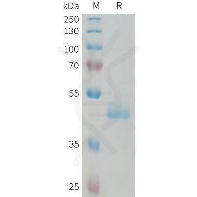 sp-PME101331 PIP Fig.1 SDS PAGE 1