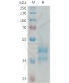 sp-PME101332 CCL24 Fig.1 SDS PAGE 1
