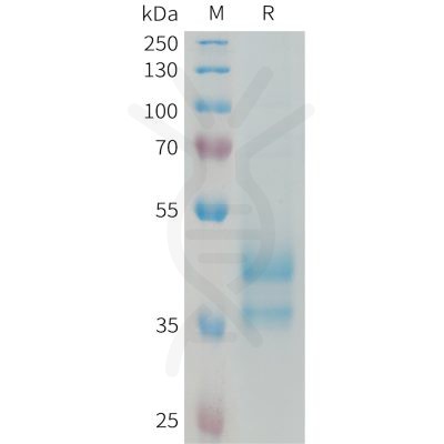 sp-PME101332 CCL24 Fig.1 SDS PAGE 1