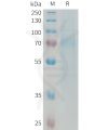 sp-PME101333 RTN4R Fig.1 SDS PAGE 1