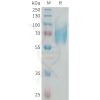 sp-PME101335 NTRK2 Fig.1 SDS PAGE 1