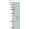 sp-PME101336 KIR3DL3 Fig.1 SDS PAGE 1