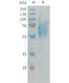 sp-PME101337 FGFR2 Fig.1 SDS PAGE 1