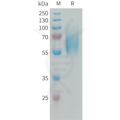 sp-PME101337 FGFR2 Fig.1 SDS PAGE 1