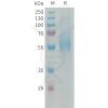 sp-PME101338 MSR1 Fig.1 SDS PAGE 1