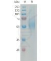 sp-PME101338 MSR1 Fig.1 SDS PAGE 1