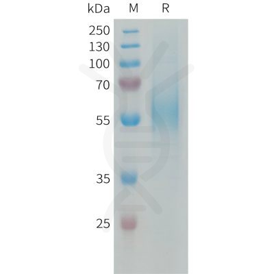 sp-PME101338 MSR1 Fig.1 SDS PAGE 1