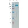 sp-PME101339 AOC3 Fig.1 SDS PAGE 1