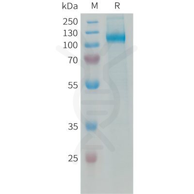 sp-PME101339 AOC3 Fig.1 SDS PAGE 1