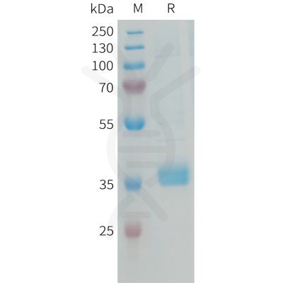 sp-PME101340 MFAP4 Fig.1 SDS PAGE 1
