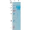 sp-PME101341 MAG Fig.1 SDS PAGE 1