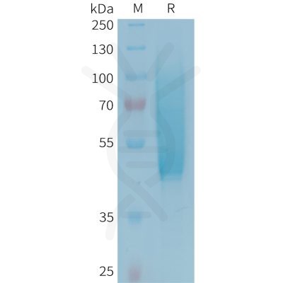 sp-PME101343 CX3CL1 Fig.1 SDS PAGE 1