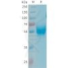 sp-PME101344 APOH Fig.1 SDS PAGE 1