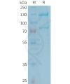 sp-PME101347 C5 Fig.1 SDS PAGE 1