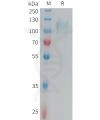 sp-PME101351 CD62E Fig.1 SDS PAGE 1