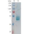sp-PME101352 IL25 Fig.1 SDS PAGE 1