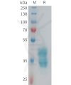 sp-PME101354 F2RL3 Fig.1 SDS PAGE 1