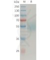 sp-PME101356 MICAa3 Fig.1 SDS PAGE 1
