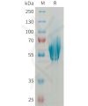 sp-PME101361 MADCAM1 Fig.1 SDS PAGE 1