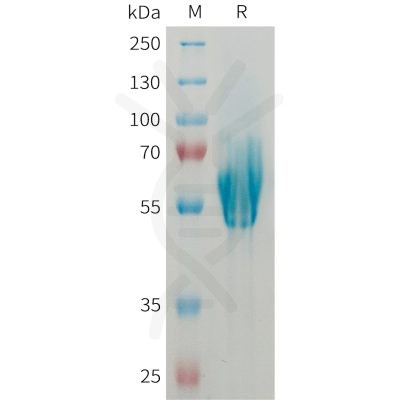 sp-PME101361 MADCAM1 Fig.1 SDS PAGE 1