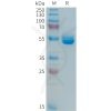 sp-PME101365 PRL Fig.1 SDS PAGE 1