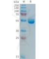sp-PME101365 PRL Fig.1 SDS PAGE 1
