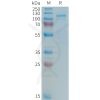 sp-PME101366 LRP5 Fig.1 SDS PAGE 1