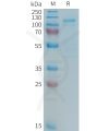 sp-PME101366 LRP5 Fig.1 SDS PAGE 1
