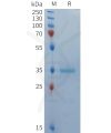 sp-PME101368 BCMA Fig.1 SDS PAGE 1