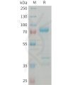 sp-PME101372 GDF8 Fig.1 SDS PAGE 1
